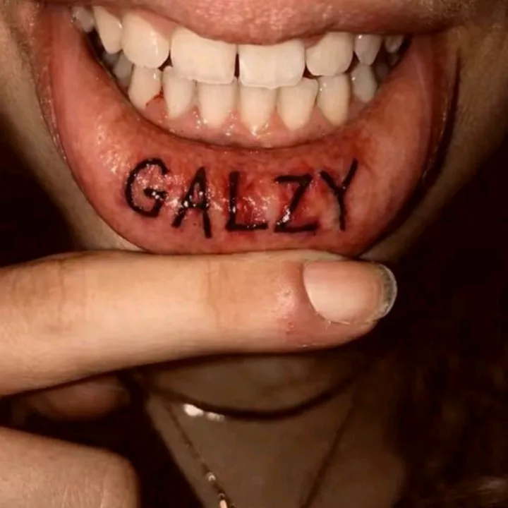galzygp_