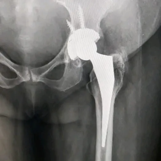 ortho_surgeon_arbind