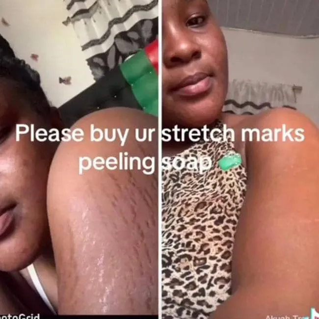 preciouspeelingsoap