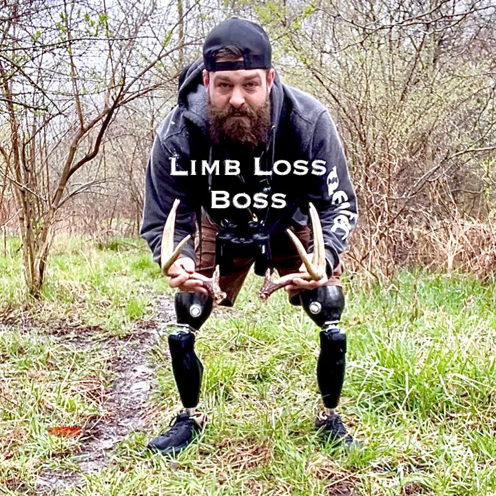 @limb_loss_boss