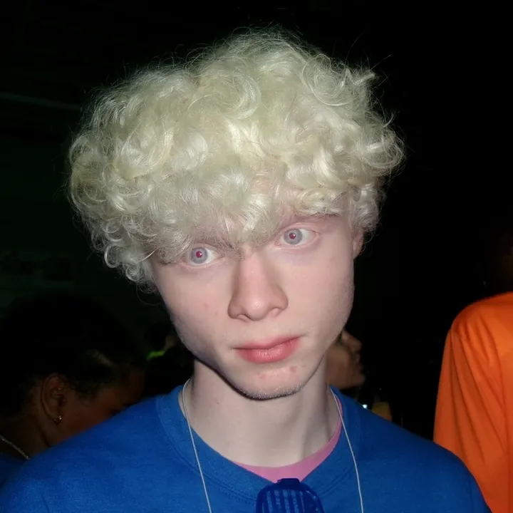 albinokai