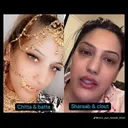 @bigexpose1