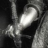 eternalcontrition