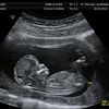 babyinside7