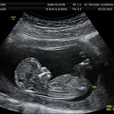 @babyinside7