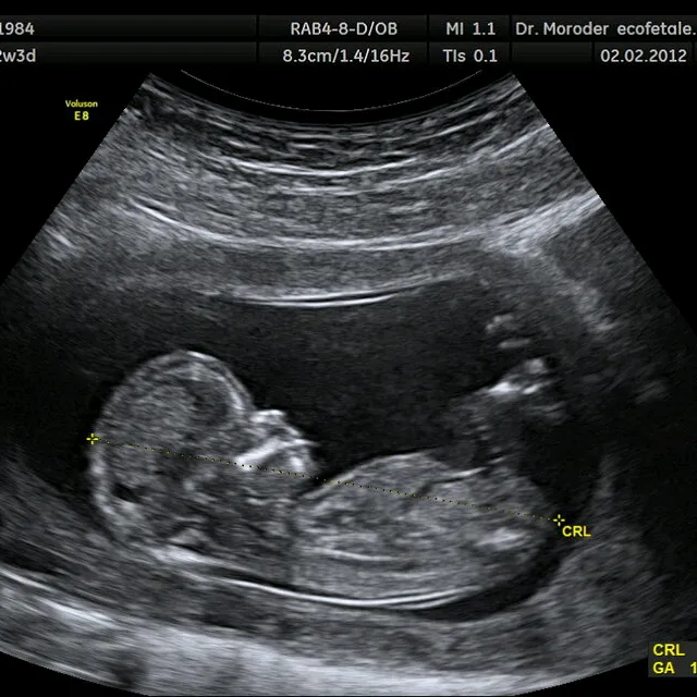 @babyinside7