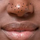 @the_pimples