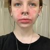 wethefrogarestonger