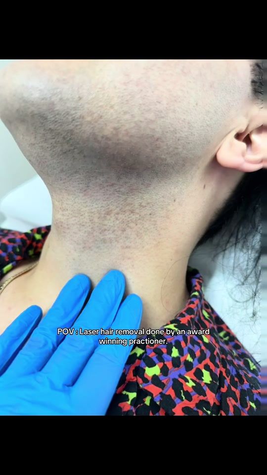 TikTok video thumbnail by rejuvalaser
