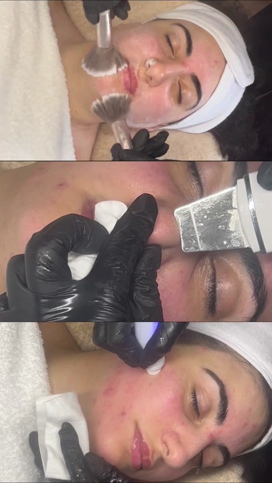 TikTok video thumbnail by my.skinglowy
