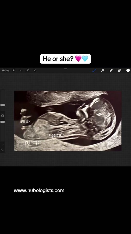 TikTok video thumbnail by thenubologists