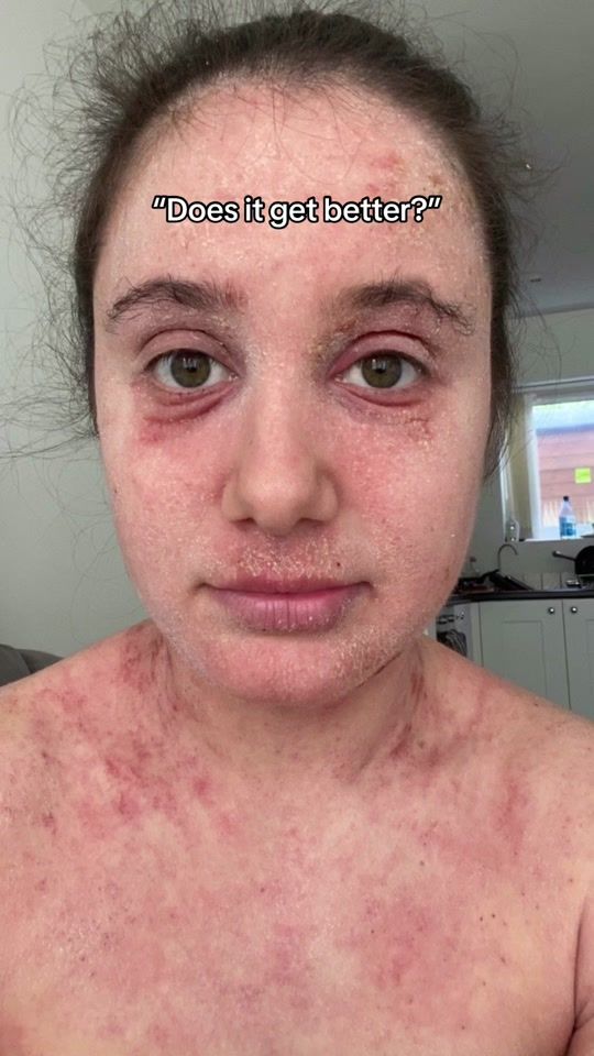 TikTok video thumbnail by hollykatefrancis