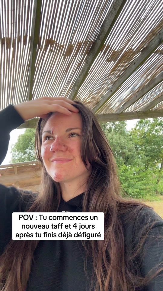 TikTok video thumbnail by viveleventdhiver