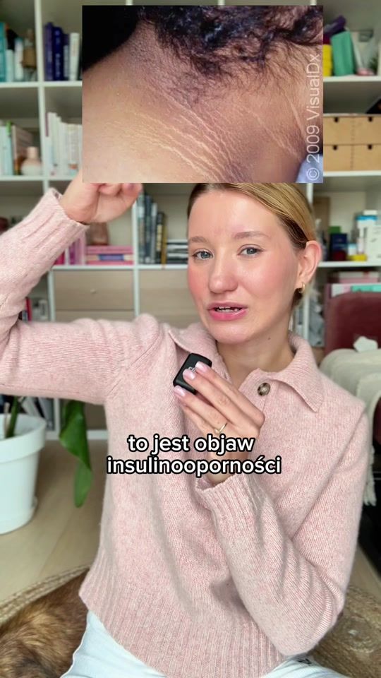 TikTok video thumbnail by dietetyk.martynaszpaczek