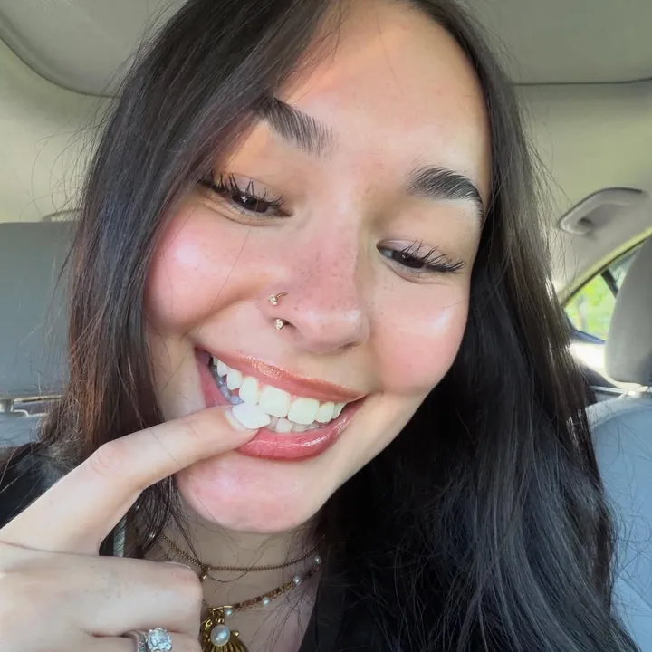 @chloejvdd