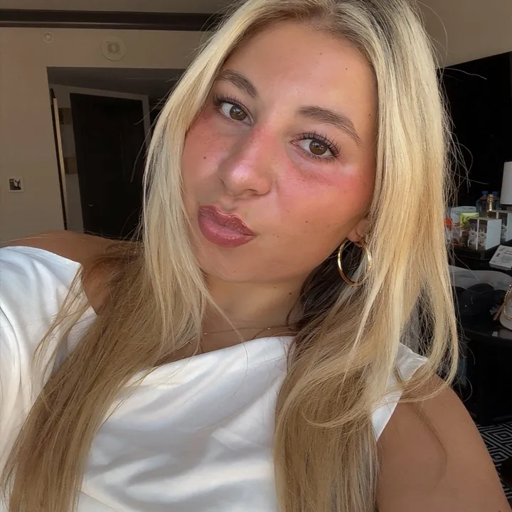 chlogurtt