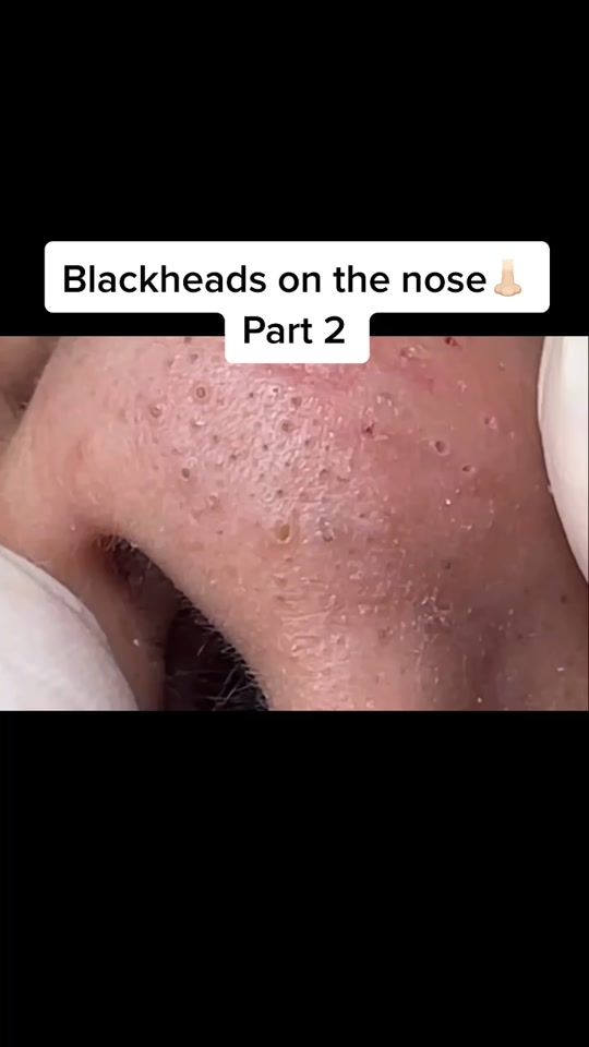 TikTok video thumbnail by ewthatsgross