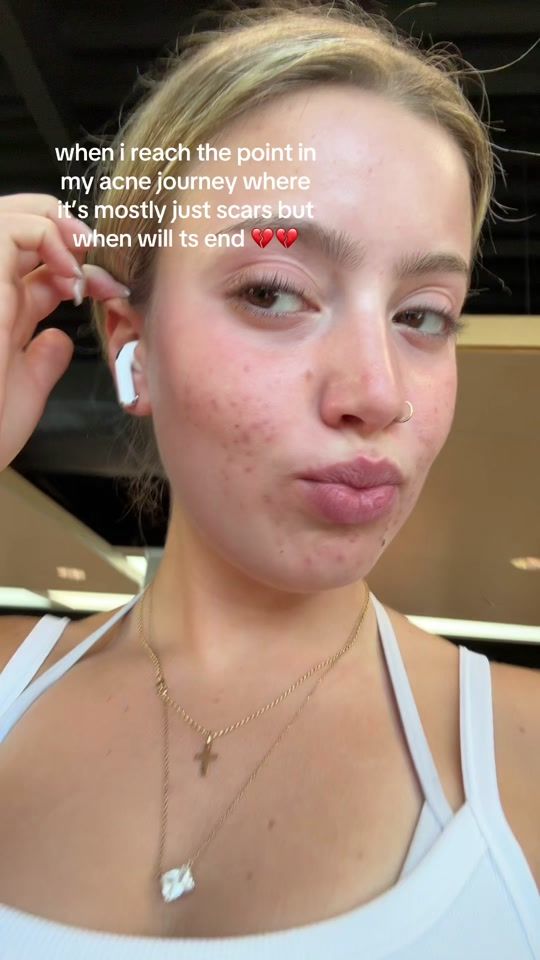 TikTok video thumbnail by cheetounicorns