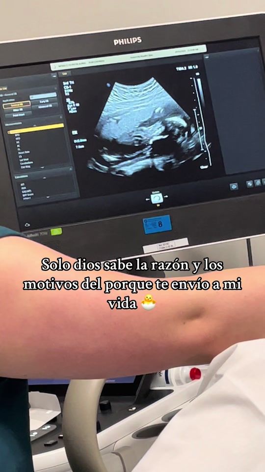 TikTok video thumbnail by elizzamh